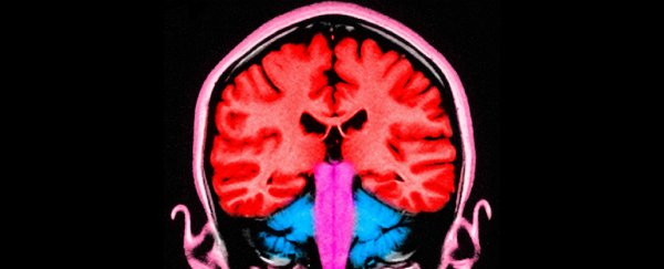6 months after surviving COVID, 1 in 3 have neurological or psychiatric problems