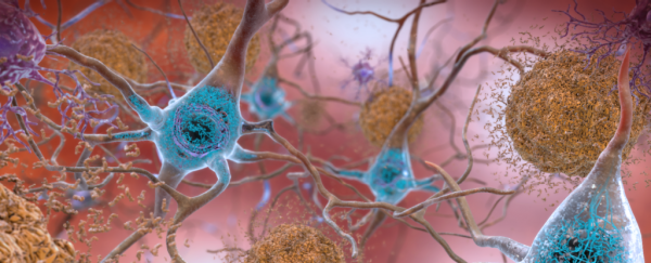 We may finally understand how the tangled proteins in dementia cause cells to die