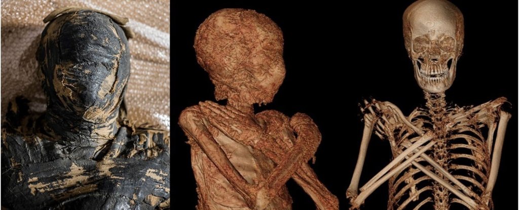 https://www.sciencealert.com/scientists-have-identified-the-world-s-first-ever-pregnant-embalmed-egyptian-mummy