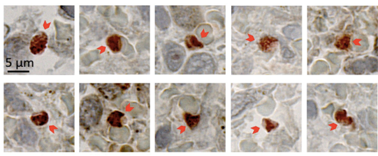 Plasmodium vivax in spleen