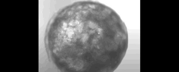 This beating sesame seed-sized 'human heart' grew itself in a lab