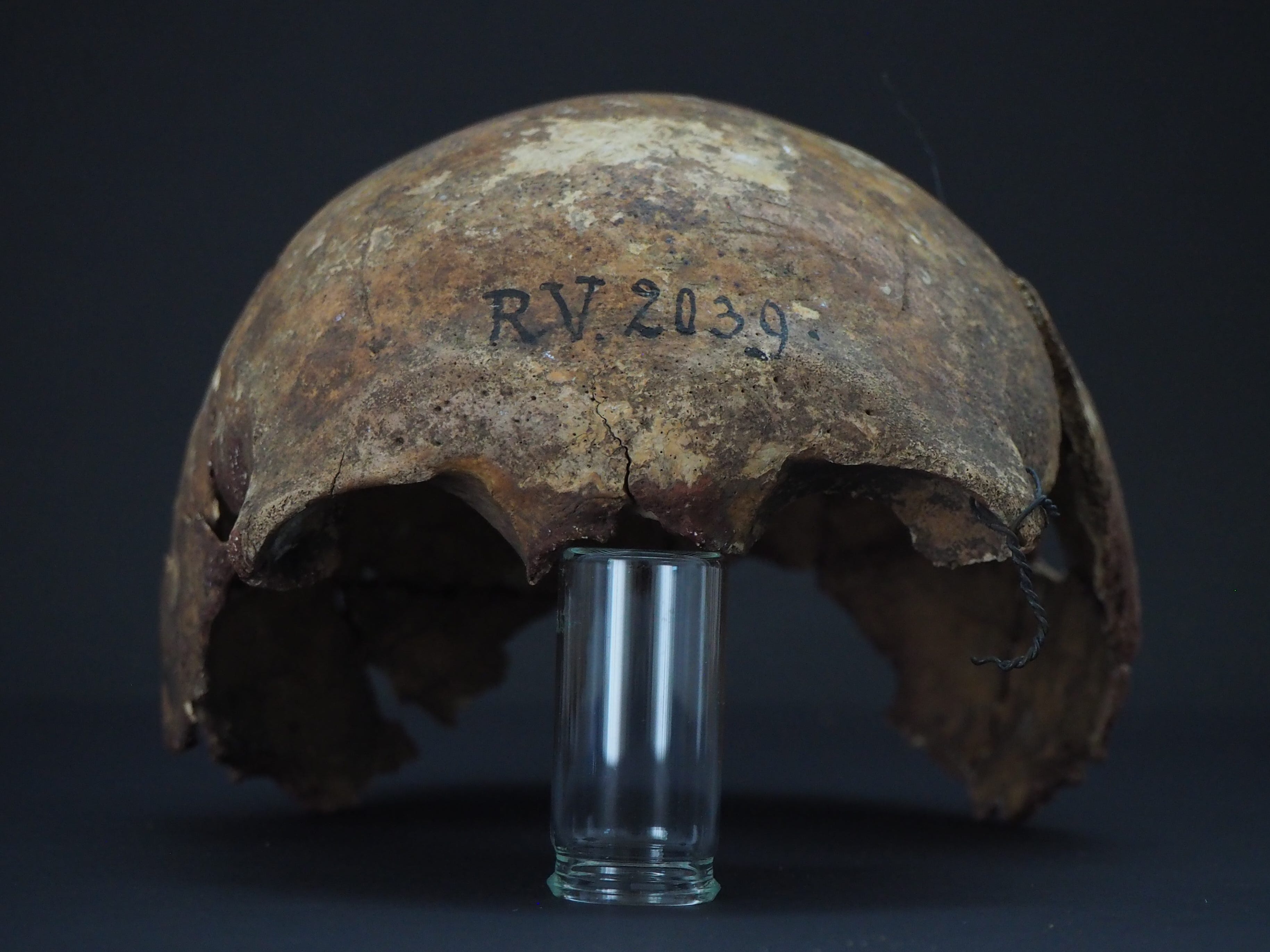 Patial skull of man who died of the plague, 5,000 years ago. (Dominik Göldner/BGAEU, Berlin)