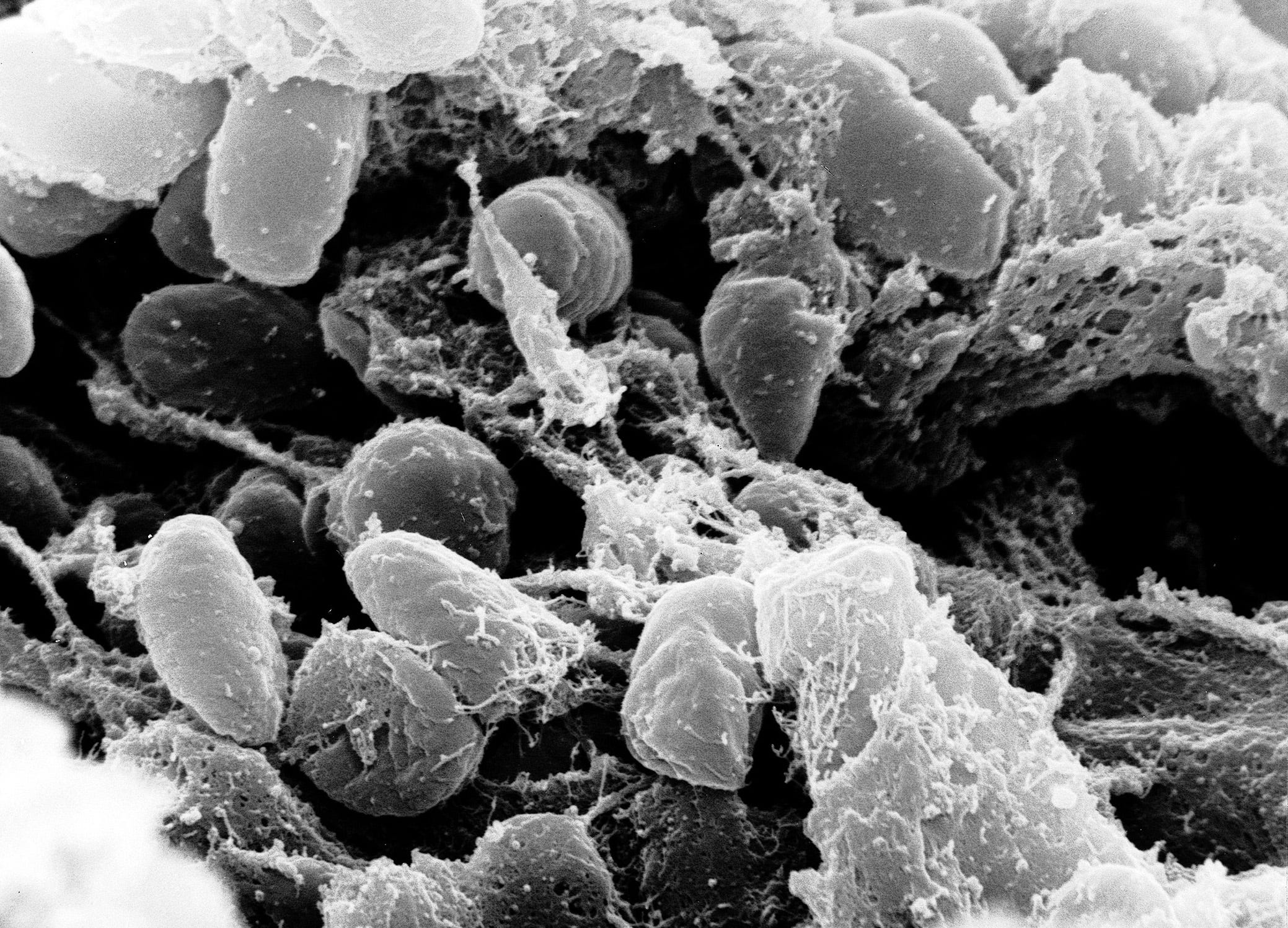 Cause of the Bubonic plague, Yersinia pestis bacteria, under a microscope. (NIAID)
