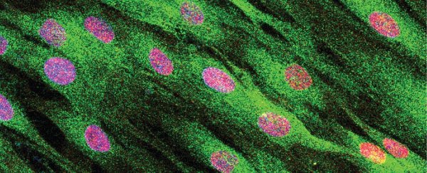 Mysterious form of ALS identified in children with rare genetic mutations