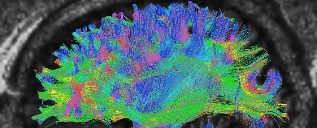 Memories Are Played Back at Super High-Speed When We're Learning New Skills - ScienceAlert