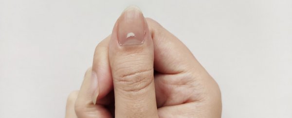 Reports are emerging of 'COVID nails'. Here's what you need to know