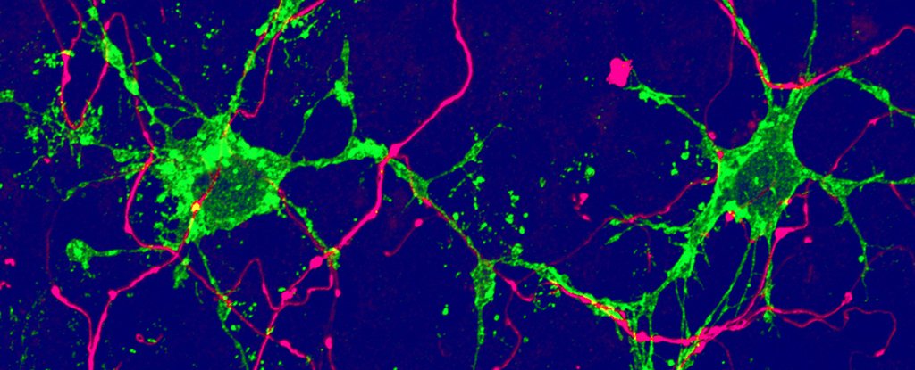 Two Previously Unknown Brain Cell Types Have Been Discovered in Mouse Study - ScienceAlert