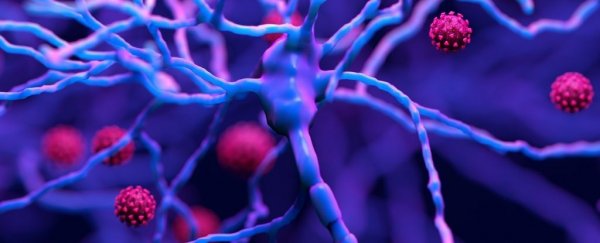 Brain inflammation from COVID-19 looks eerily similar to that from Alzheimer's