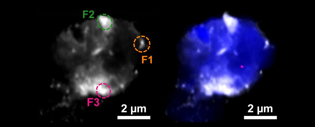 Deposits of Copper And Magnetic Iron Found in Alzheimer's Patients' Brains - ScienceAlert