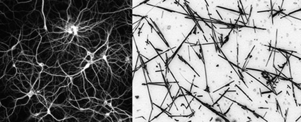An artificial network kept on the 'edge of chaos' acts much like a human brain