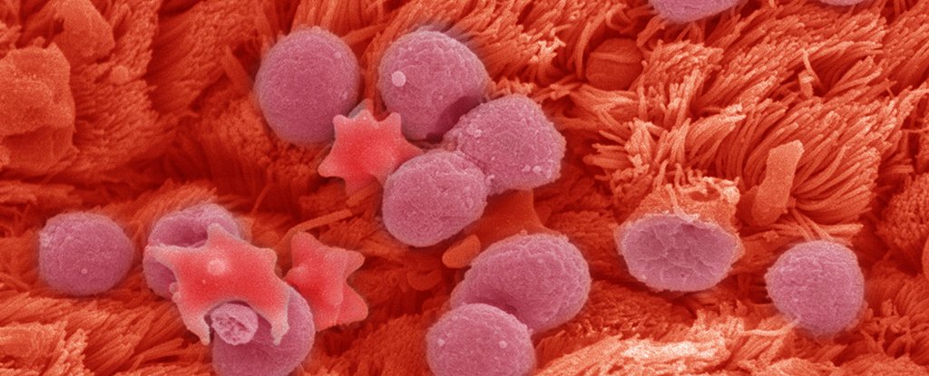 https://www.sciencealert.com/cell-study-suggests-we-might-be-able-to-stop-sars-cov-2-from-replicating