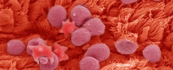 CRISPR breakthrough blocks SARS-CoV-2 virus replication in early lab tests