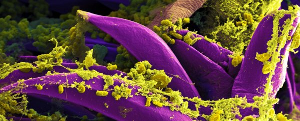 Scientists developed a new vaccine for plague, and it's ready for human trials
