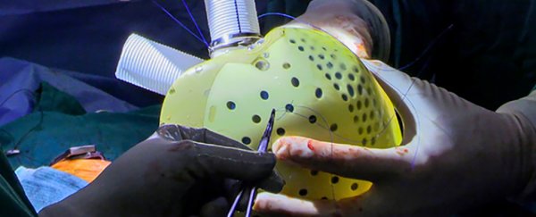 39-year-old becomes first US patient to receive 'Aeson' artificial heart implant
