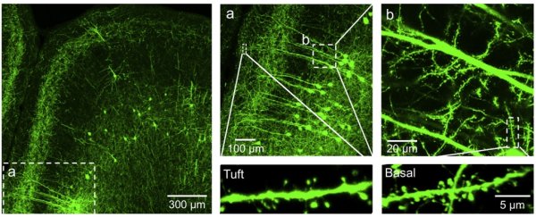 Just one dose of magic mushroom compound regrows lost brain connections in mice
