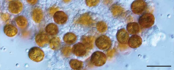 After 140 years, biologists have 'resurrected' the genus of these weird yellow cells