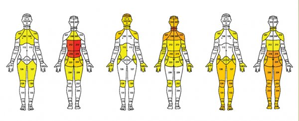 Chronic pain has 9 distinct types, according to a large new body mapping study
