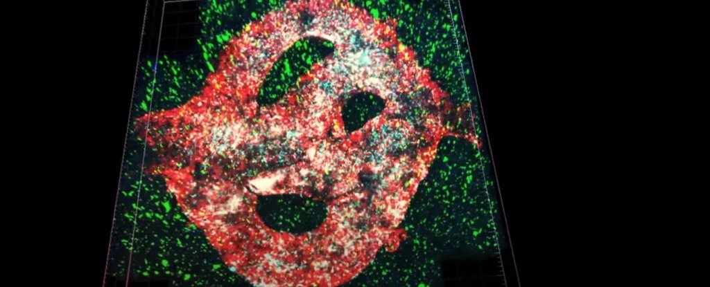 A deadly brain tumor has been 3D-printed in the lab for the first time