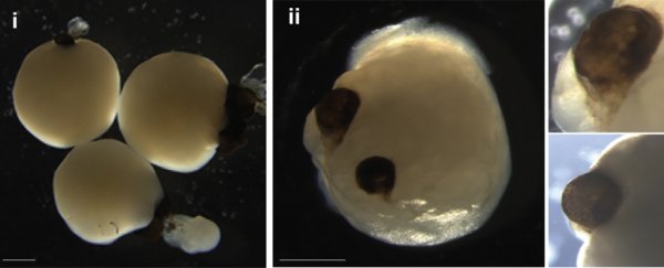 Scientists grew stem cell 'mini brains'. Then, the brains sort-of developed eyes