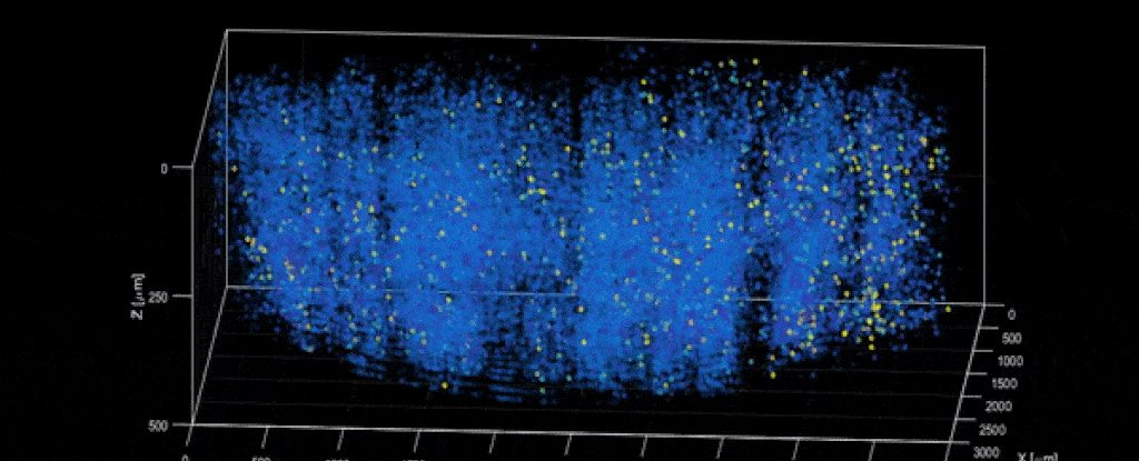 En la primera vez, los científicos rastrearon 1 millón de neuronas casi simultáneamente en el cerebro de una rata.