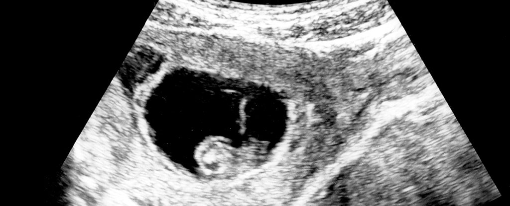 6 week ultrasound heartbeat