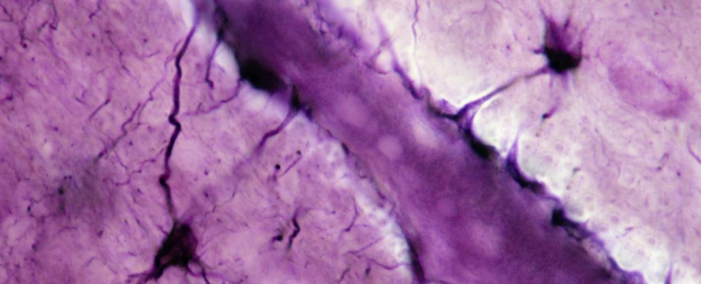 Scientists Find a Blood-to-Brain Pathway in Mice That Could Be Behind Alzheimer's - ScienceAlert