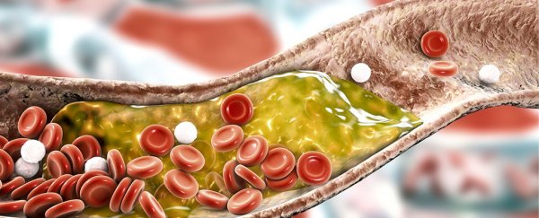 A clever 'gene silencing' injection has been approved for treating high cholesterol