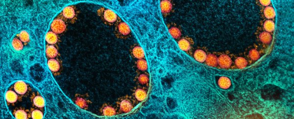 The closest related virus to SARS-CoV-2 has just been discovered, and it's in bats