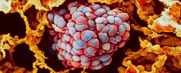 Geneticists just got closer to the sources of lung cancer in people who never smoked