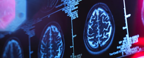 New algorithm can identify pre-Alzheimer's brain changes with over 99% accuracy