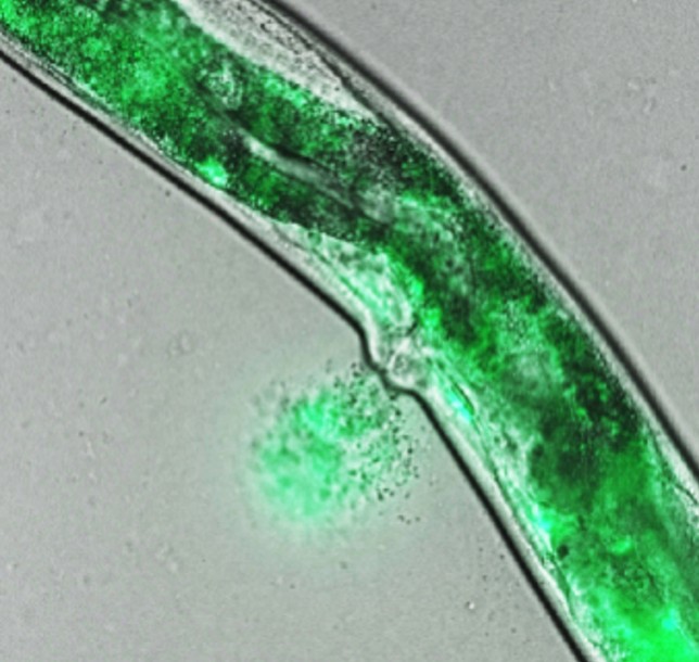 C. elegans squirting yolk milk through their vulva. (UCL)