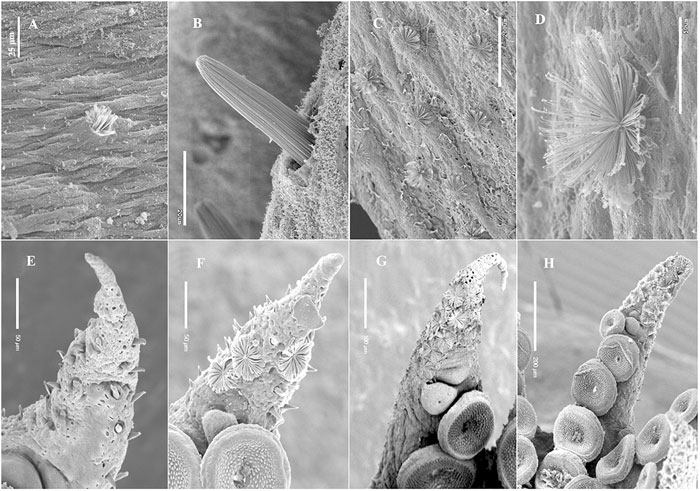 SeriesOfPicturesShowTheKollikerOrganDevelopmentOnATentacle