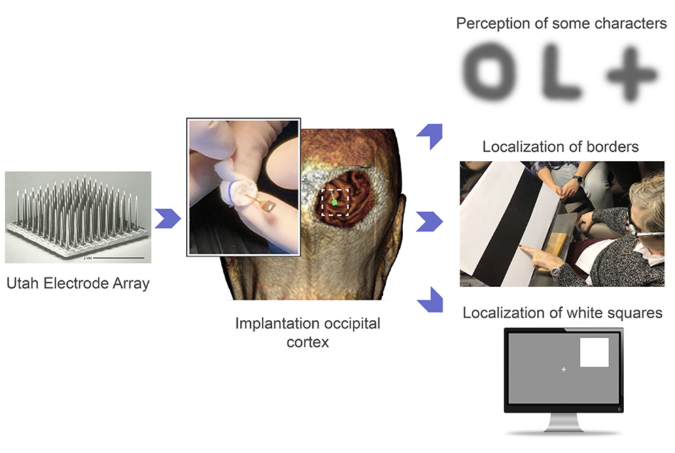 The Utah Electrode Array in action