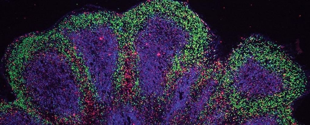 'Mini-Brains' The Size of Peas Are Helping Us Study Incurable Neurological Condi..