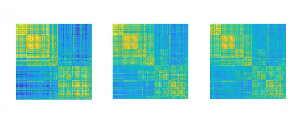 It Only Takes 100 Seconds to Get an Identifiable 'Fingerprint' of Your Brain