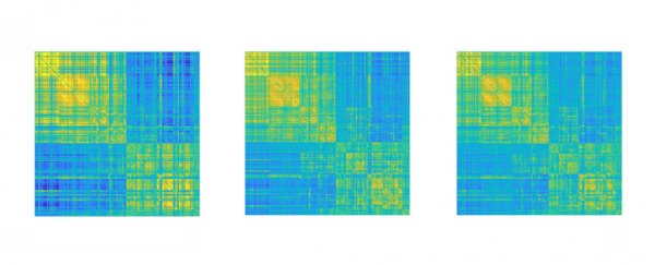 It only takes 100 seconds to get an identifiable 'fingerprint' of your brain