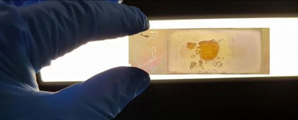 Microscopic nanotech color slides could change how we identify disease