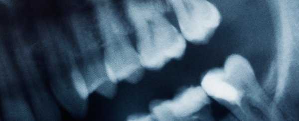 Scientists finally know why wisdom teeth only emerge when we're basically adults