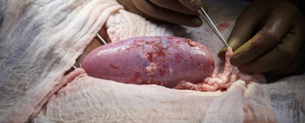 Pig kidney successfully transplanted into a human patient for the first time ever