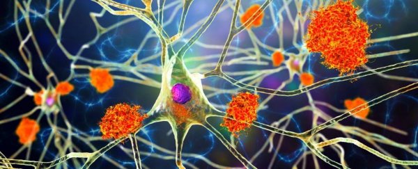 Amyloid plaques in Alzheimer's Disease