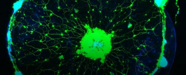Scientists discovered a way to read the minds of jellyfish, and it's phenomenal