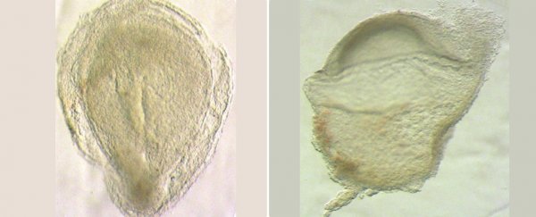 'Landmark' study gives unprecedented glimpse at mysterious phase of the human embryo