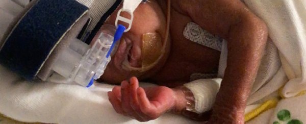 Premature baby with less than 1% survival chance officially breaks the world record