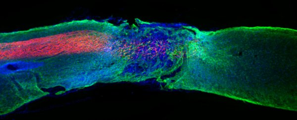 In an astonishing feat, a new drug reversed paralysis in mice with spinal cord injury