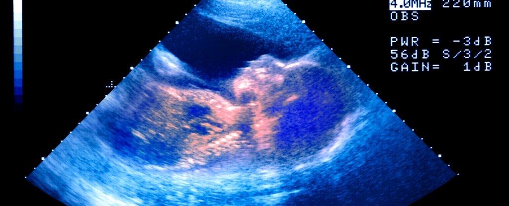 Do Babies Cry in The Womb? Ultrasounds Show Something Strange Going On