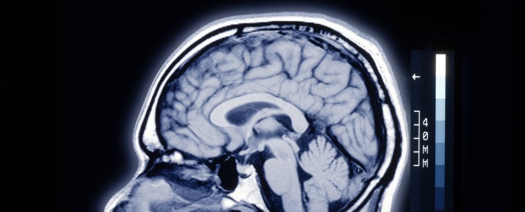 There's a Strange Difference Between Human Brains And Those of Other Mammals  : ScienceAlert