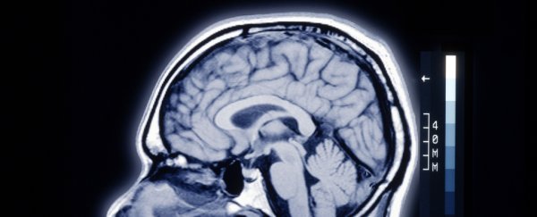 There's a strange difference between human brains and those of other mammals