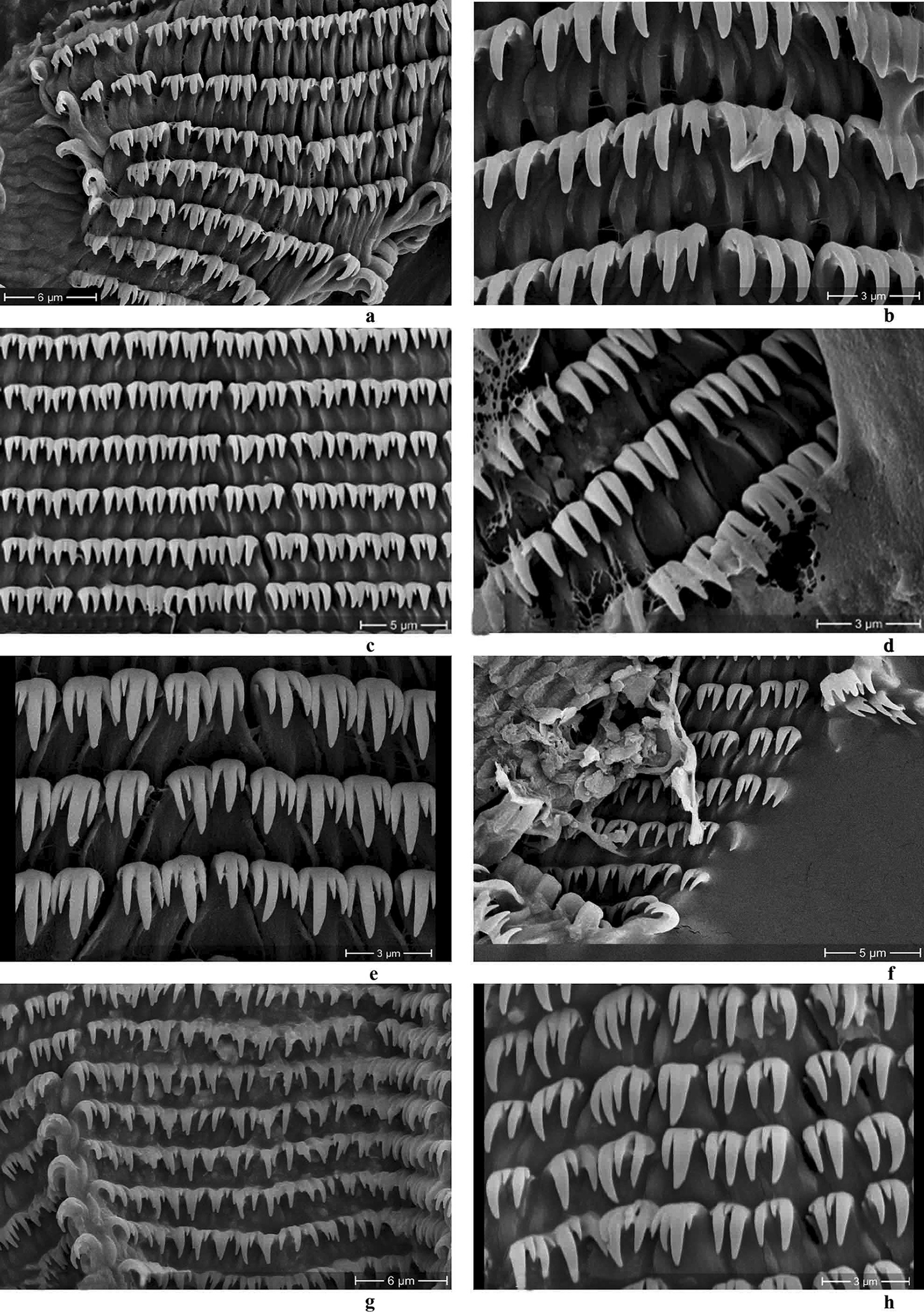 Four different species' radulas under the microscope with close ups.