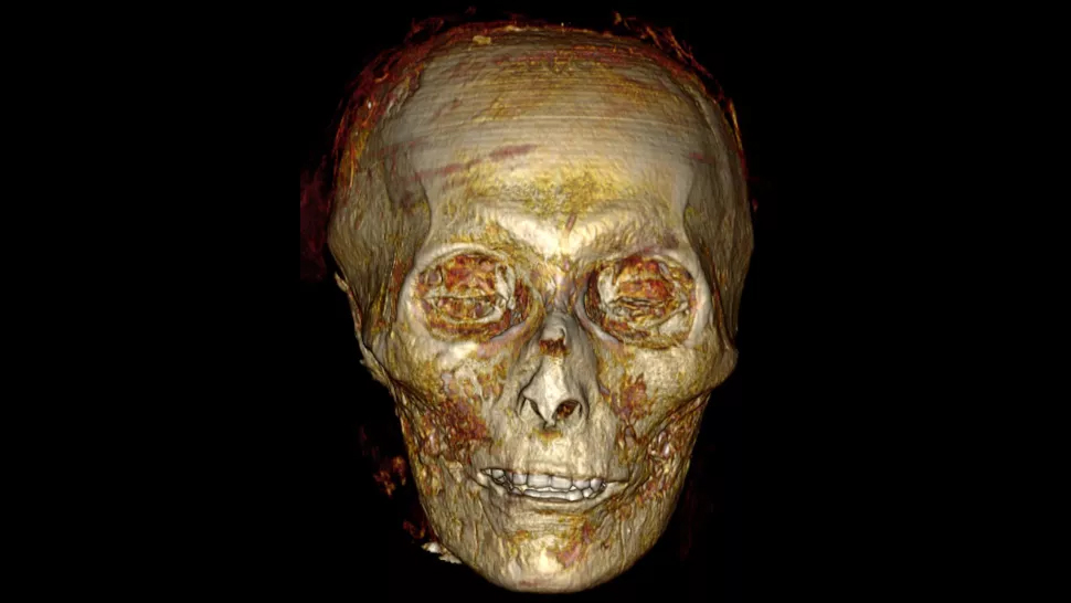 Pharaoh's skull showed his teeth were in good condition at the time of death. (S. Saleem/Z. Hawass)