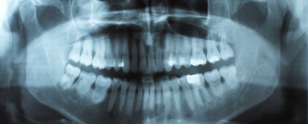 Grinding your teeth? Here's why and what you can do about it